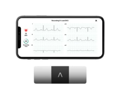 AliveCor KardiaMobile 6L | Moniteur ECG Personnel Connecté à 6 Dérivations - Détection de la Fibrillation Auriculaire en 30 Secondes